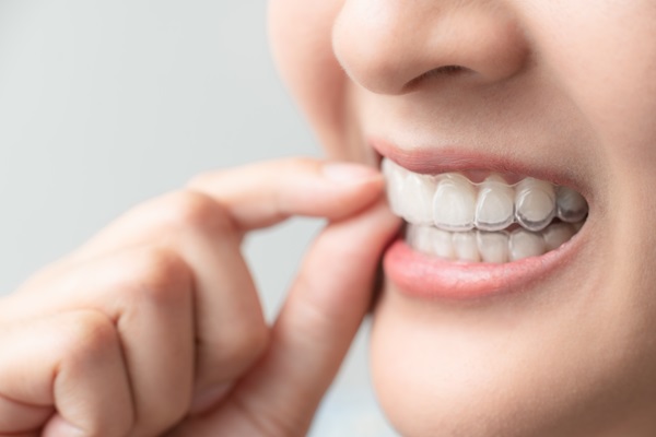 What Can Clear Aligners Correct?