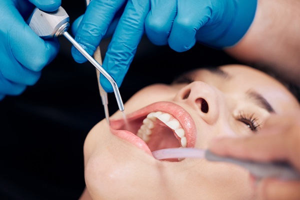 When A Deep Teeth Cleaning Is Recommended For Periodontal Health